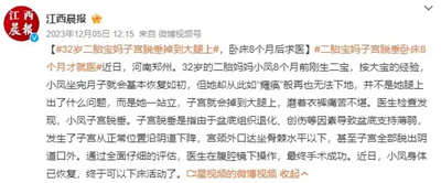 图片细节